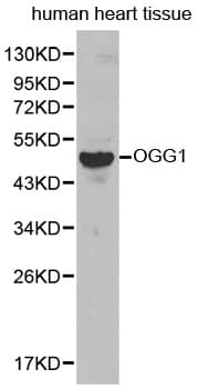 Polyclonal Rabbit anti-Human OGG1 Antibody (IHC, WB)
