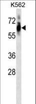 Polyclonal Rabbit anti-Mouse CDK8 Antibody (aa245-272, WB)