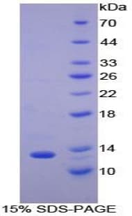 Mouse CCL8 / MCP2 Protein (Recombinant His-T7)