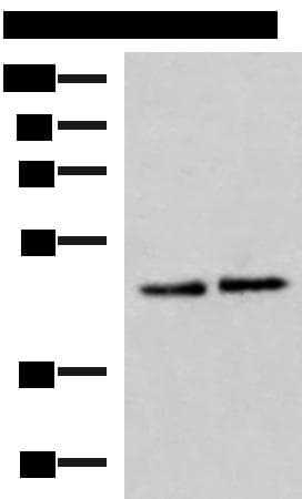 BAF53B / ACTL6B Antibody