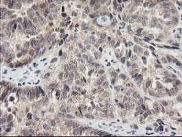 MEIS3 Antibody (aa1-261, clone OTI2E12, Carrier-free)