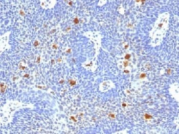 Monoclonal Mouse anti-Human Papillomavirus HPV16 E6 Antibody (clone HPV16/1296, Azide-free,BSA-free, IHC)