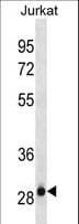 Monoclonal Mouse anti-Human HAGH Antibody (aa279-308, WB)