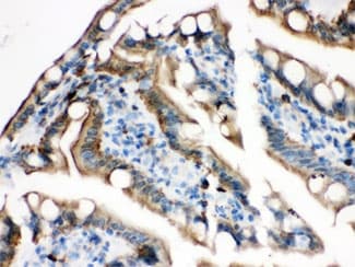 PLEC / Plectin Antibody