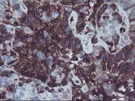 AHSG / Fetuin A Antibody (clone OTI2H2)