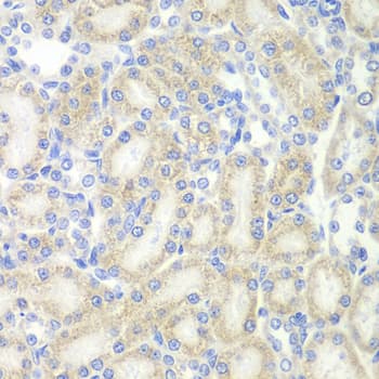 Polyclonal Rabbit anti-Human MAP2 Antibody (IHC, WB)