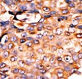 PANK3 Antibody (aa150-181)