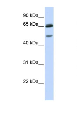 Polyclonal Rabbit anti-Human GABRG2 Antibody (aa36-85, WB)