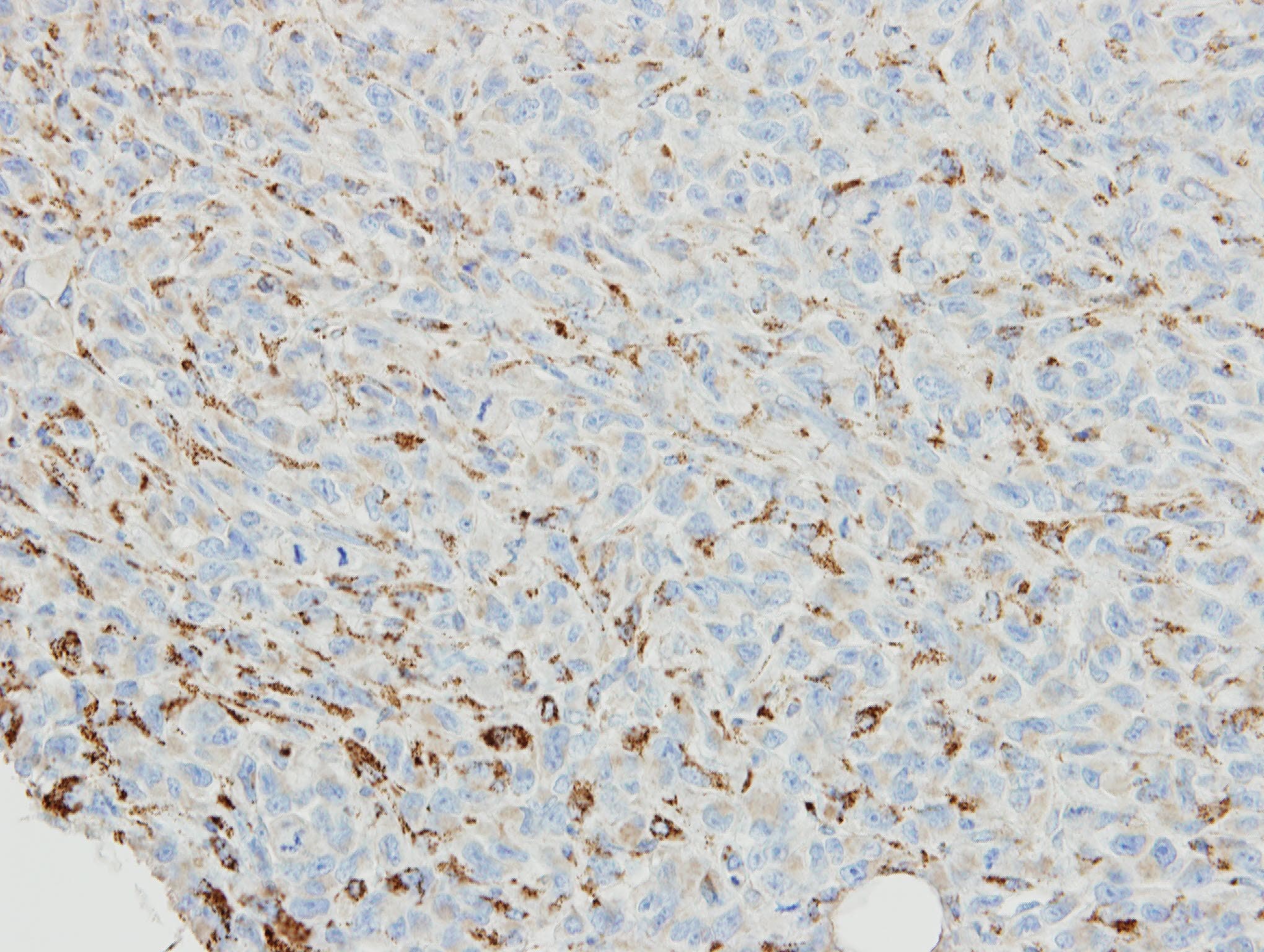 SNX18 Antibody (aa566-628)