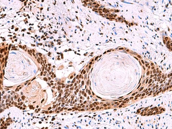 Polyclonal Rabbit anti-Human SF3B130 / SF3B3 Antibody (IHC)