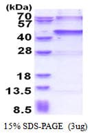 Human USP46 Protein (Recombinant His)