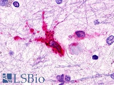 PathPlus™ C3AR / C3a Receptor Antibody (Extracellular Domain)