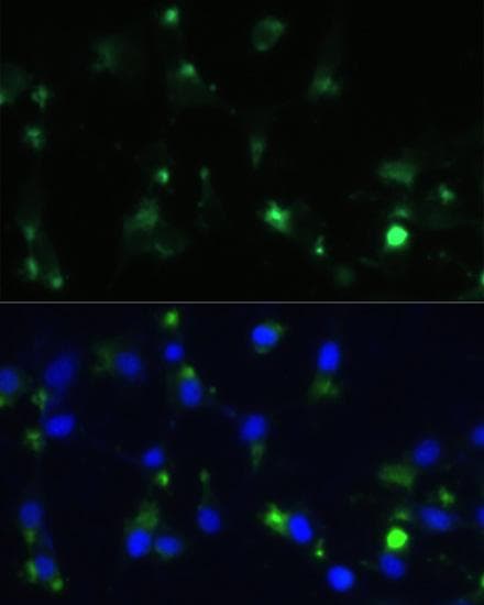 ENO1 / Alpha Enolase Antibody