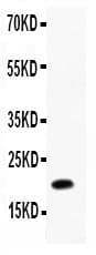 IL12B / IL12 p40 Antibody (aa23-321)