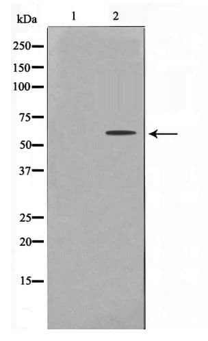 Polyclonal Rabbit anti-Human UBXN11 / SOC Antibody (IHC, WB)