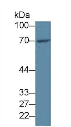 FOXO1 / FKHR Antibody (aa333-557, Biotin)