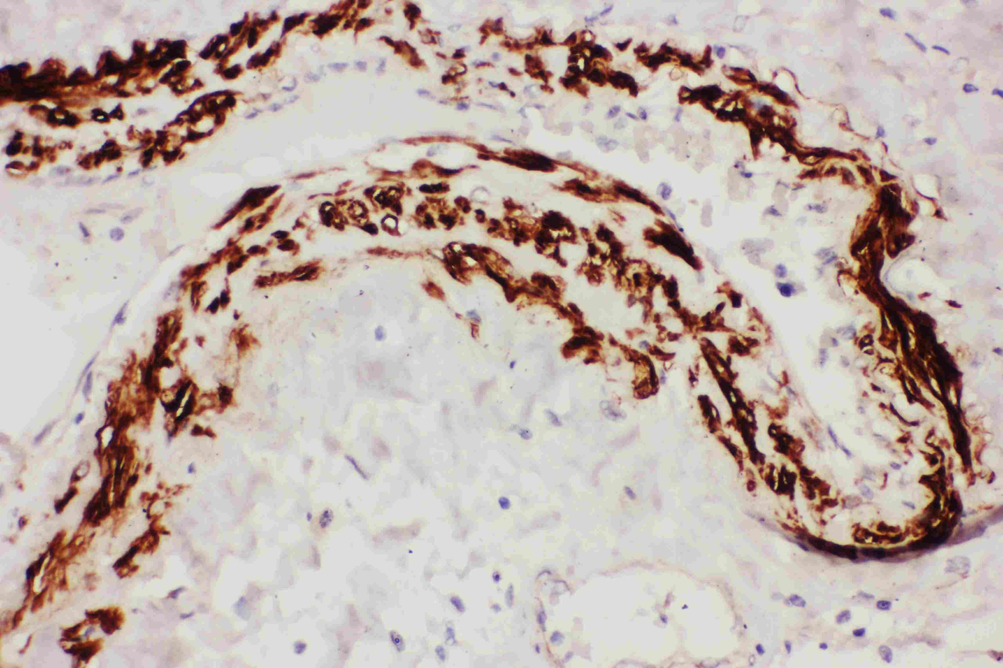 Polyclonal Rabbit anti-Human TFPI / LACI Antibody (aa261-280, IHC, WB)