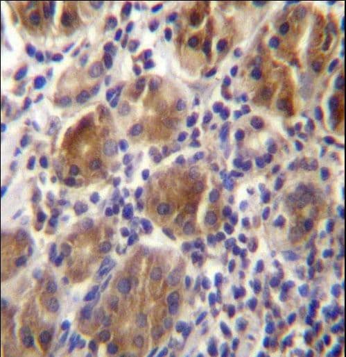MLPH / Melanophilin Antibody (aa541-569)