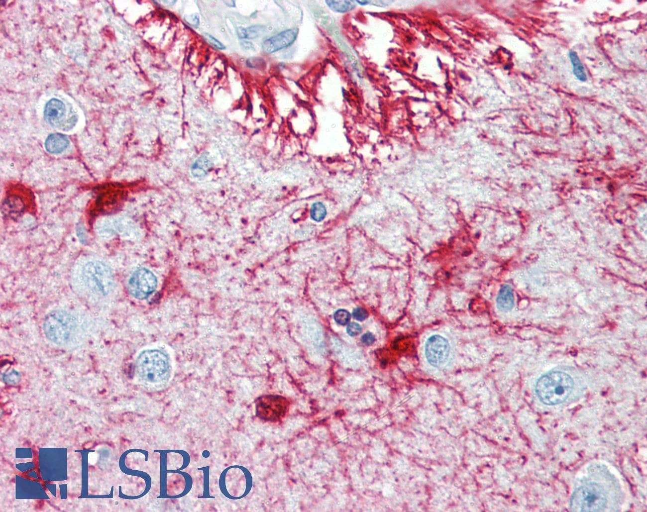 PathPlus™ S100B / S100 Beta Antibody (clone 9A11B9)