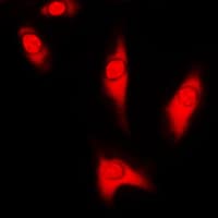 Polyclonal Rabbit anti-Human PARK7 / DJ-1 Antibody (Internal, IHC, IF, WB)