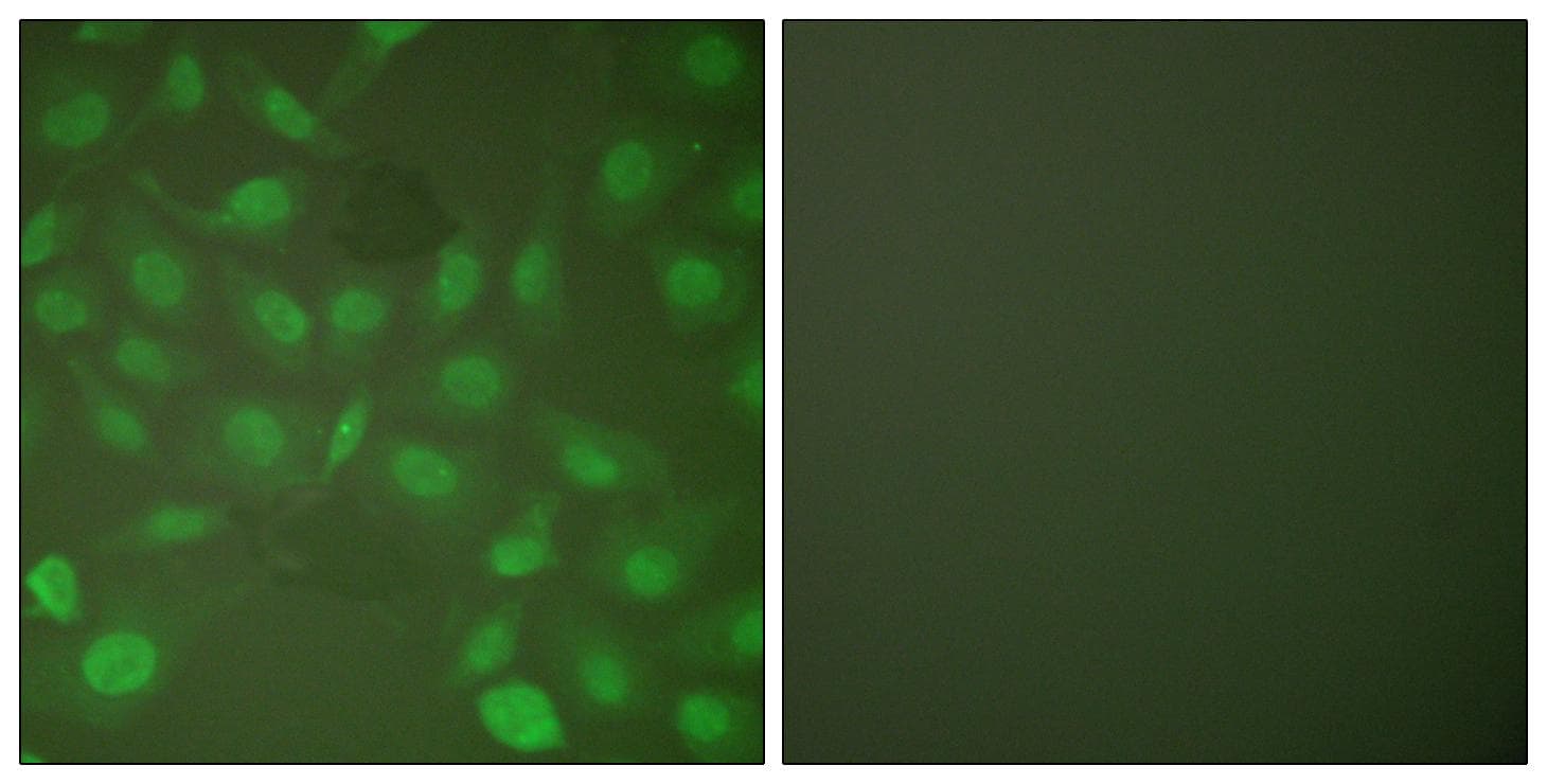 Polyclonal Rabbit anti-Human C/EBP Beta / CEBPB Antibody (phospho-Thr235/188, IHC, IF, WB)