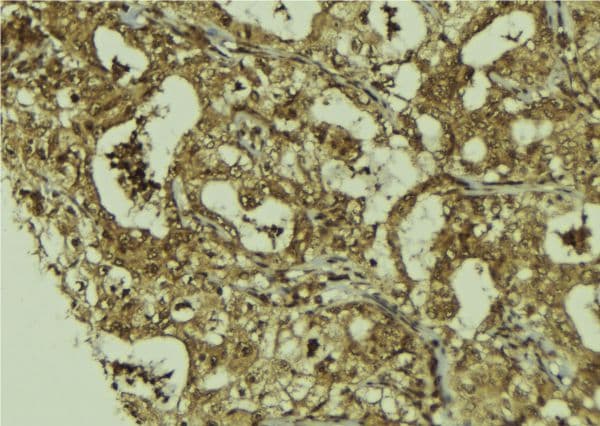 DIS3 Antibody