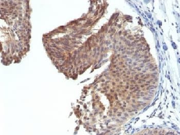 KRT6 / CK6 / Cytokeratin 6 Antibody (clone KRT6/1702)