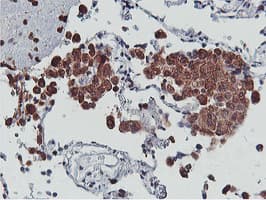 APMAP / C20orf3 Antibody (clone OTI1D7)