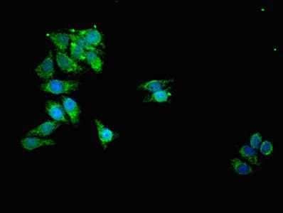 IHC-plus™ Polyclonal Rabbit anti-Human TOMM20 Antibody (aa20-145, IHC, IF, WB)