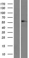 Vimentin Protein (Over-Expression Lysate Myc-DDK (Flag))