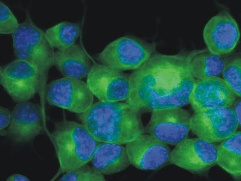 IHC-plus™ Monoclonal Mouse anti-Human TUBB3 / Tubulin Beta 3 Antibody (clone TU-20, C-Terminus, IHC, WB)