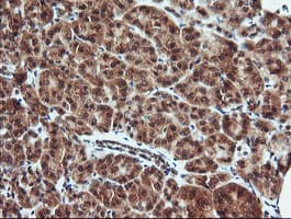 KLK8 / Kallikrein 8 Antibody (clone OTI3C10)