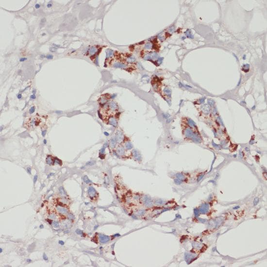 Polyclonal Rabbit anti-Human ACSL3 Antibody (IHC)