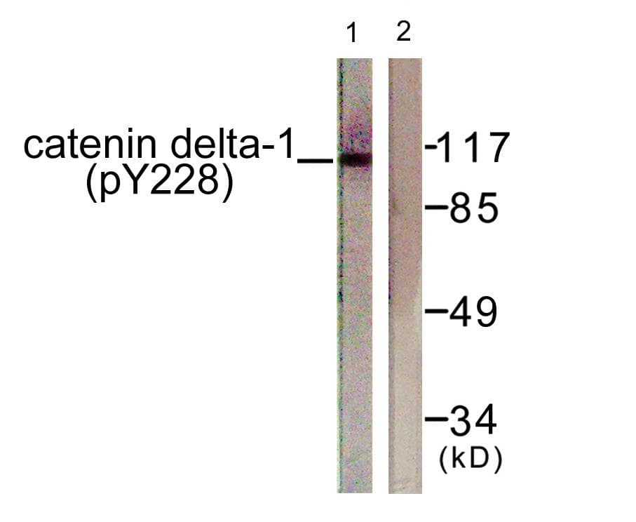 CTNND1 / p120 Catenin Antibody (phospho-Tyr228)