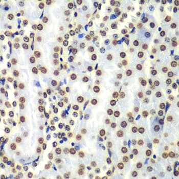 Polyclonal Rabbit anti-Human Histone H3 Antibody (IHC, IF, WB)