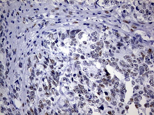 ZEB1 / AREB6 Antibody (aa1-350, clone OTI9A3)