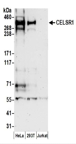 Polyclonal Rabbit anti-Human CELSR1 Antibody (aa2964-3014, WB)