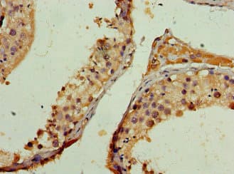 NCOA1 / SRC-1 Antibody