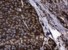 HSPD1 / HSP60 Antibody (clone OTI3G1)