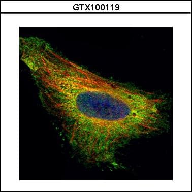 IHC-plus™ TIP30 / HTATIP2 Antibody