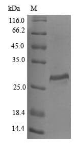 Human CTSO Protein (Recombinant 10His, N-terminus + Myc, C-terminus)