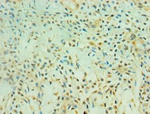 SIRT3 / Sirtuin 3 Antibody (aa20-130)