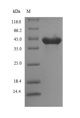 Lymantria dispar Multicapsid Nuclear Polyhedrosis P39 Protein (Recombinant 10His, N-terminus + Myc, C-terminus)