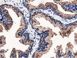 OSBP Antibody (clone OTI1F2)