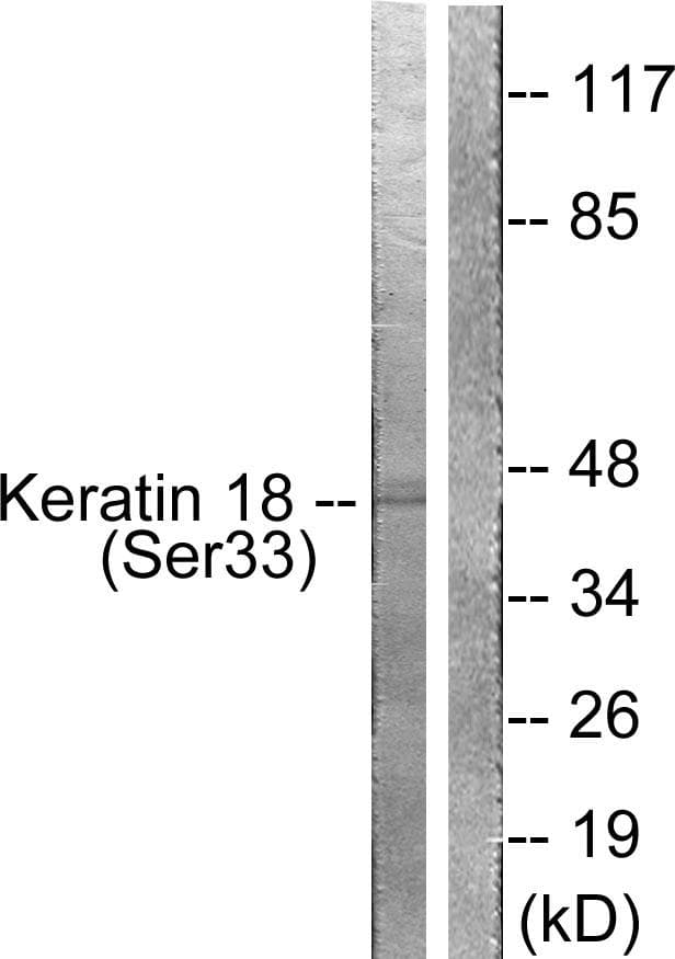 KRT18 / CK18 / Cytokeratin 18 Antibody (phospho-Ser33)