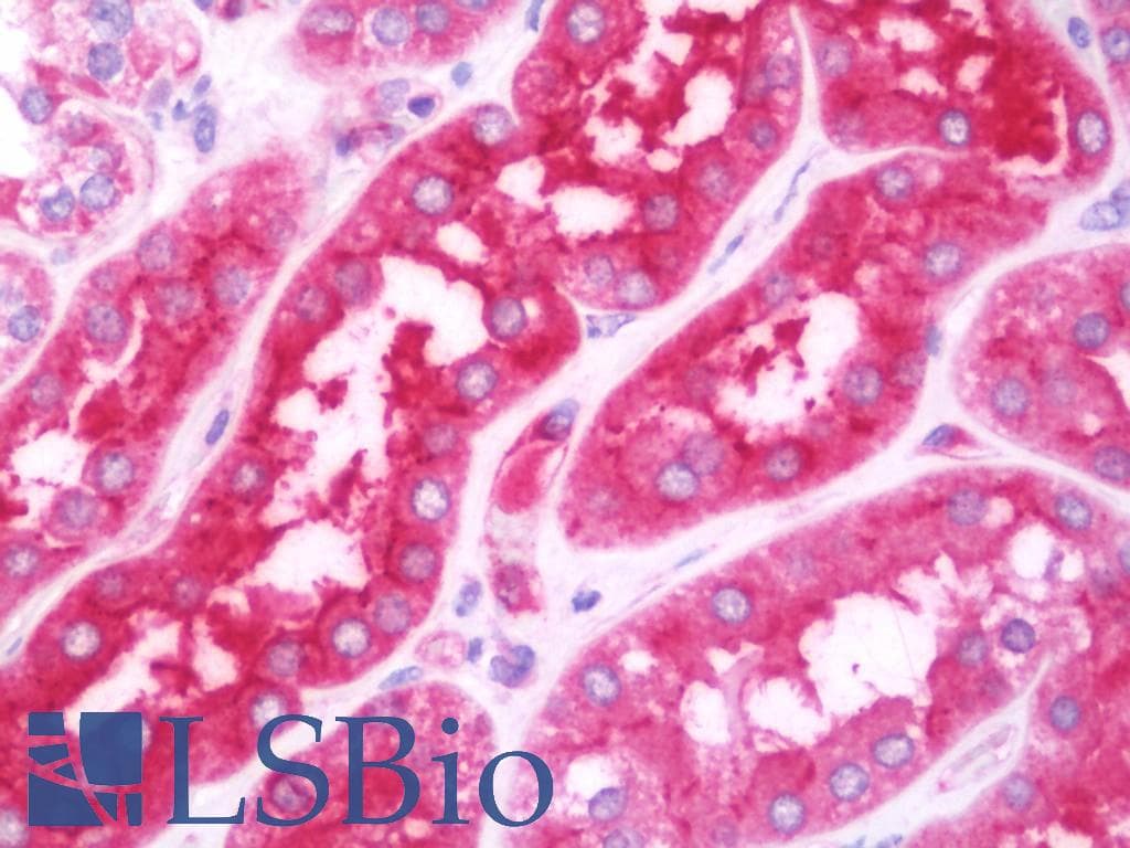 IHC-plus™ Polyclonal Rabbit anti-Human RDX / Radixin Antibody (aa95-434, IHC, WB)