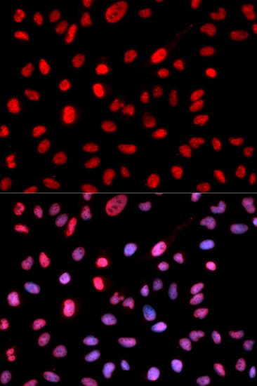 DNMT / DNMT1 Antibody (phospho-Ser714)