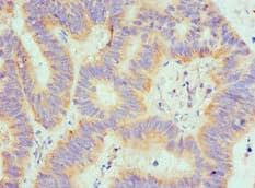 Polyclonal Rabbit anti-Human SPTLC1 / HSN1 Antibody (aa37-310, IHC, WB)