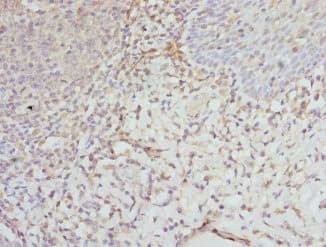 Polyclonal Rabbit anti-Human EIF2S3 / EIF2G Antibody (IHC, WB)