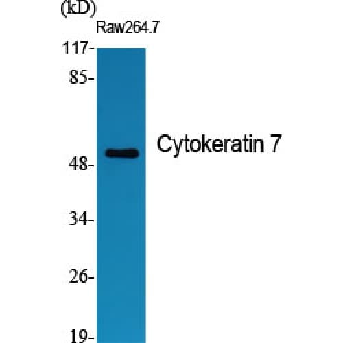 Polyclonal Rabbit anti-Human KRT7 / CK7 / Cytokeratin 7 Antibody (390-470 aa, C-terminal, IHC, IF, WB)